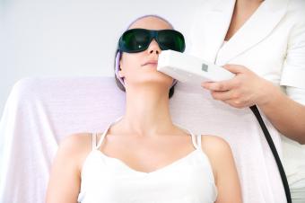 laser epilation treatment