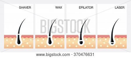 Waxing Near Me