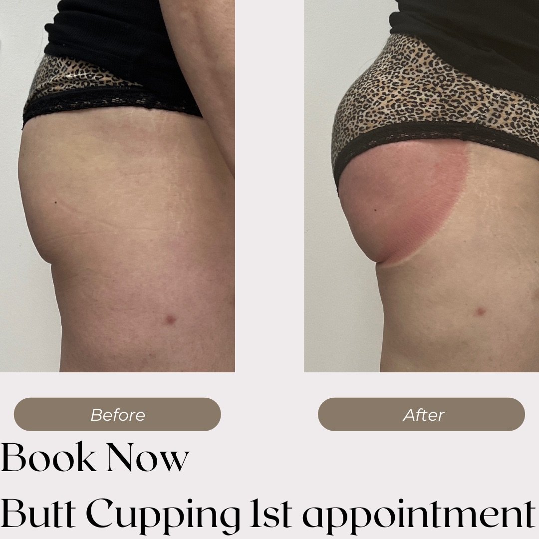 Butt Cupping