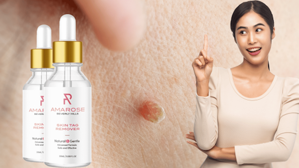 Amarose Skin Tag Remover Reviews – Does This Skin Mole And Tag Remover Really Work? Read Amarose Skin Tag Remover Consumer Reports Before Buy!