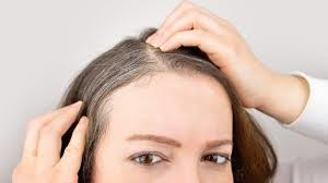 White Hair Removal