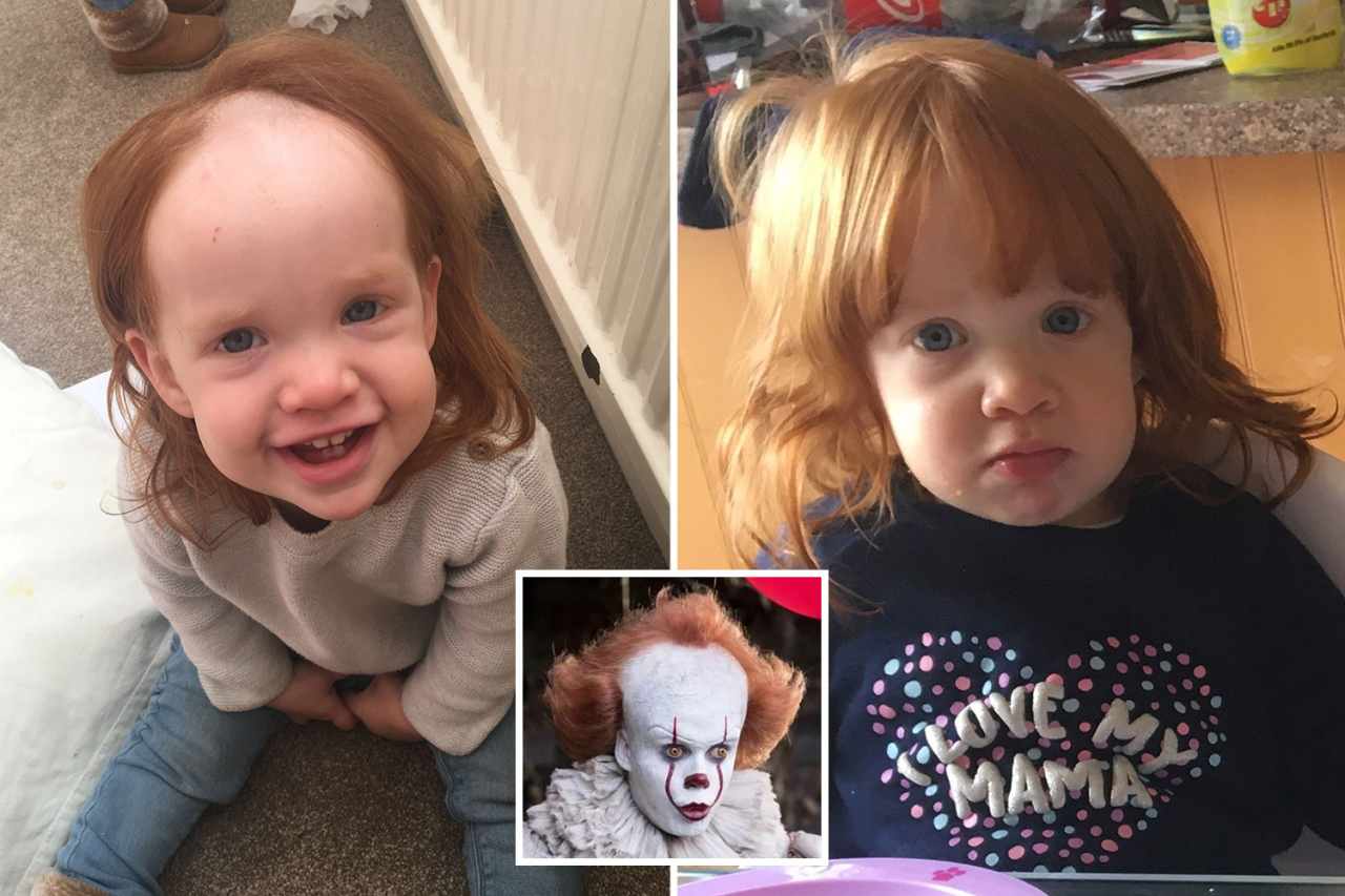 Toddler left looking like Pennywise the Clown after smearing head with hair removal cream