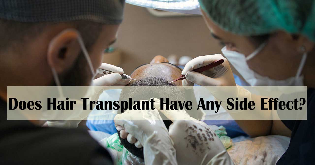 Does Hair Transplant Have Any Side Effect?