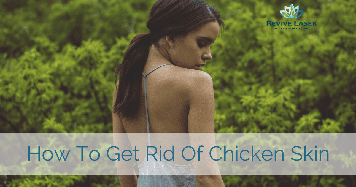 How to get rid of chicken skin