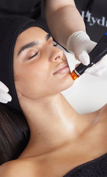 Nashville Chemical Peel