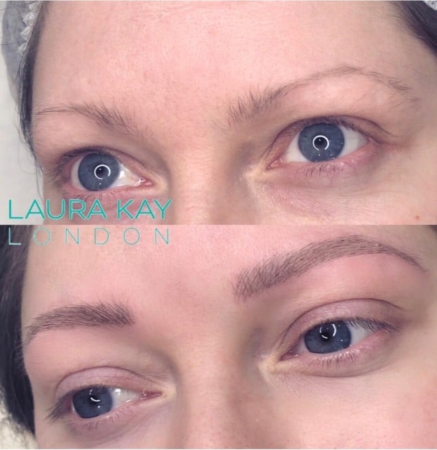 When Can You Exercise After Microblading?