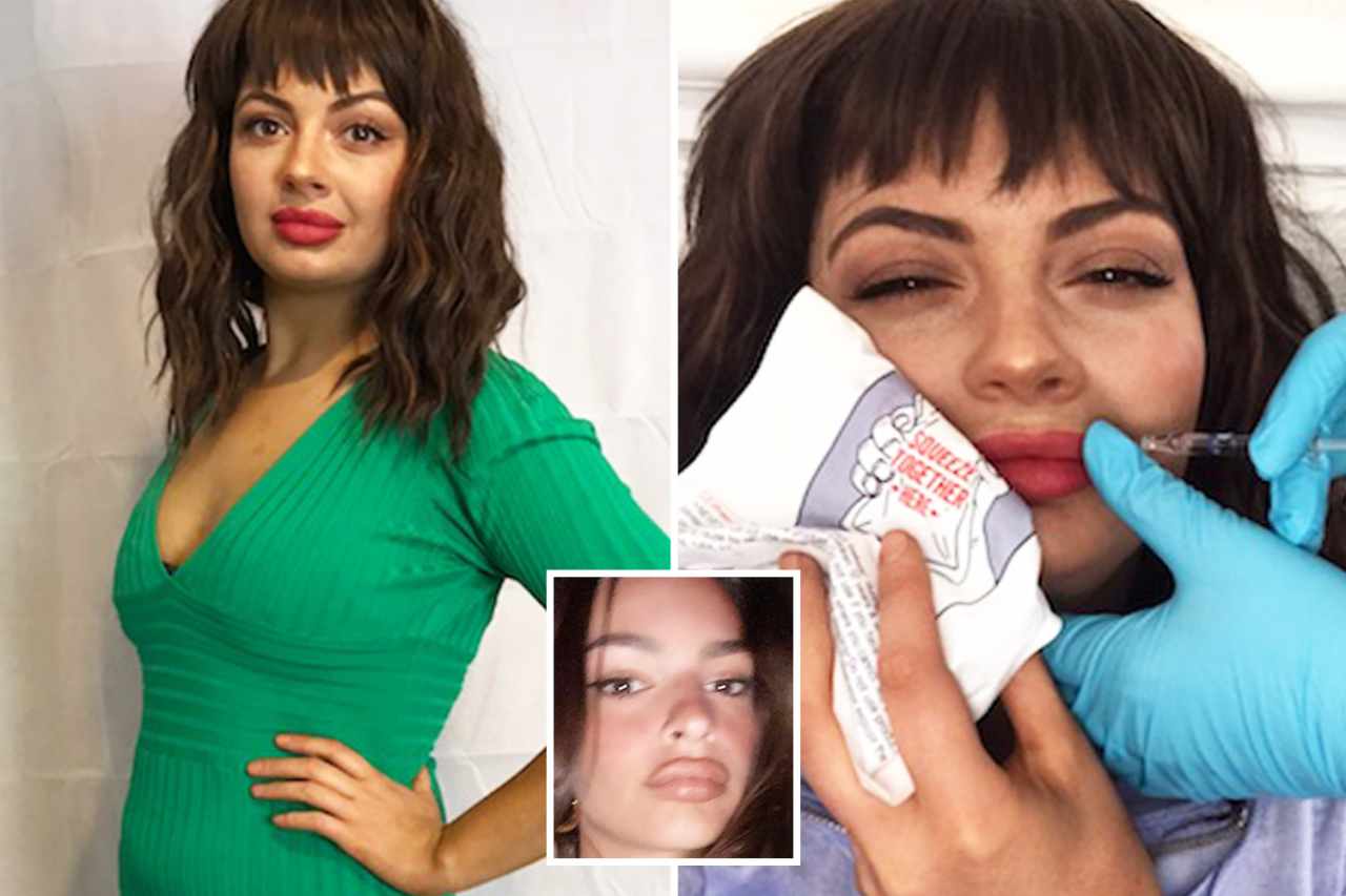 I’ve had £1.5k of Botox, filler & waxing by sneaking a beautician in during lockdown – I’d rather be ill than look rough