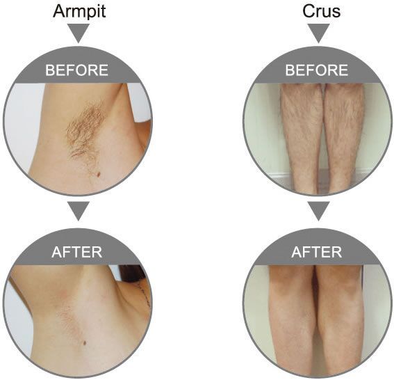 Expert Waxing Services for Smooth Skin