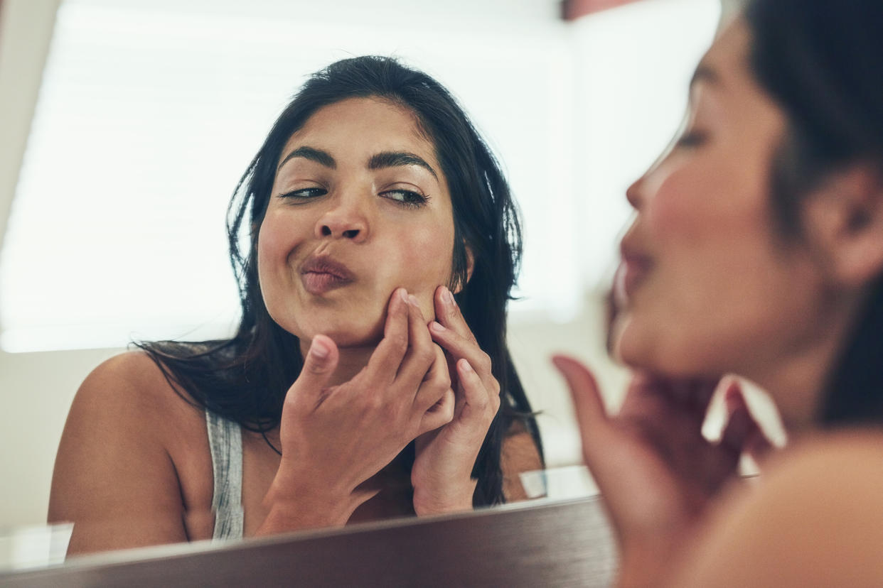 PCOS symptoms include increased acne and male-pattern hair growth, such as hair growing on a woman's chin or chest. (Photo: Getty Images)