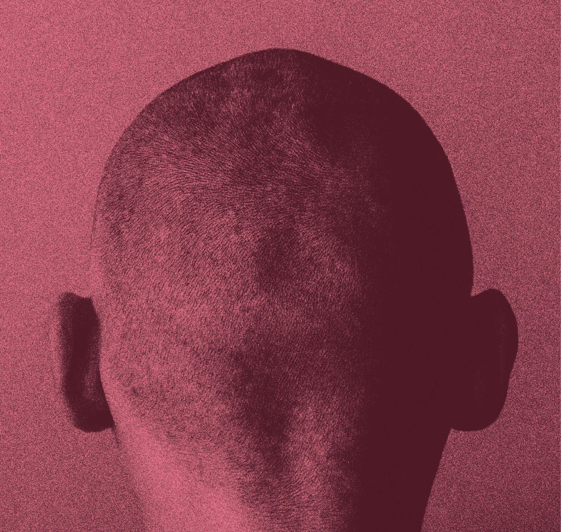 Facing bald