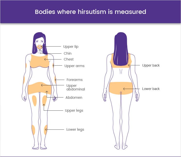 Bodies where hirsutism is measured