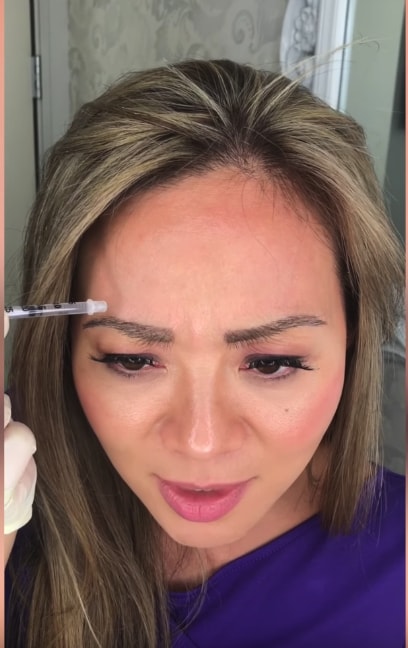 botox injection being self done by an asian lady