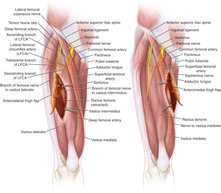 Anterolateral and Anteromedial Thigh Flaps