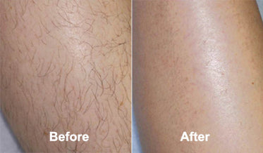 Best Permanent Hair Removal Cream For Face & Body