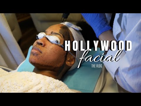 Hollywood Microdermabrasion