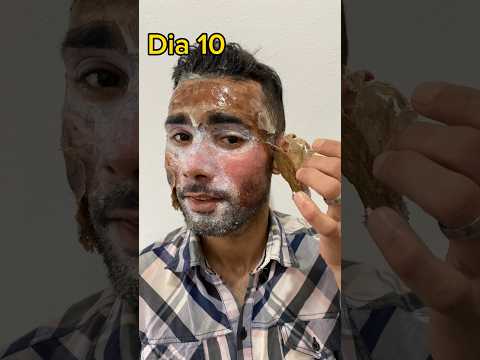 Hollywood Facials