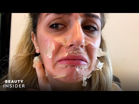 Hollywood Microneedling