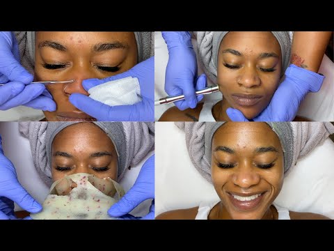 Hollywood Facials