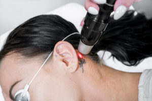 Tattoo removal: why use a medically-trained professional?