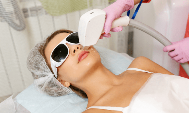 Dermal Fillers