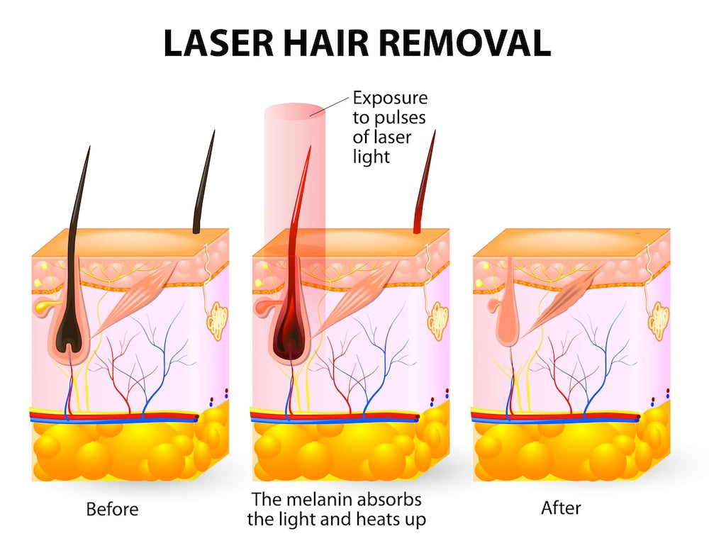 Some Of Waxing