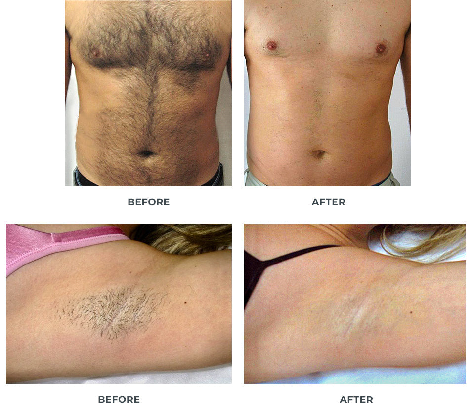 Medspa Raleigh Nc