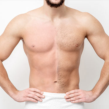 male-hair-removal-featured – Gravity Medical Spa