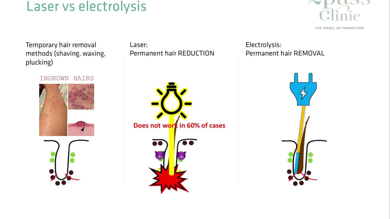 Laser Hair Removal