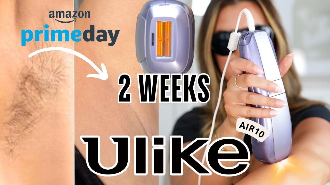 NEW Ulike Air10 IPL Hair Removal at Home (Before/After Results)