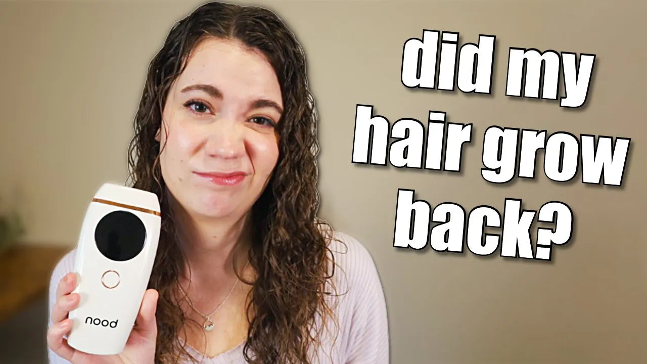 Temporary or Permanent? Kathy’s Experience with Hair Regrowth After Nood Flasher 2.0