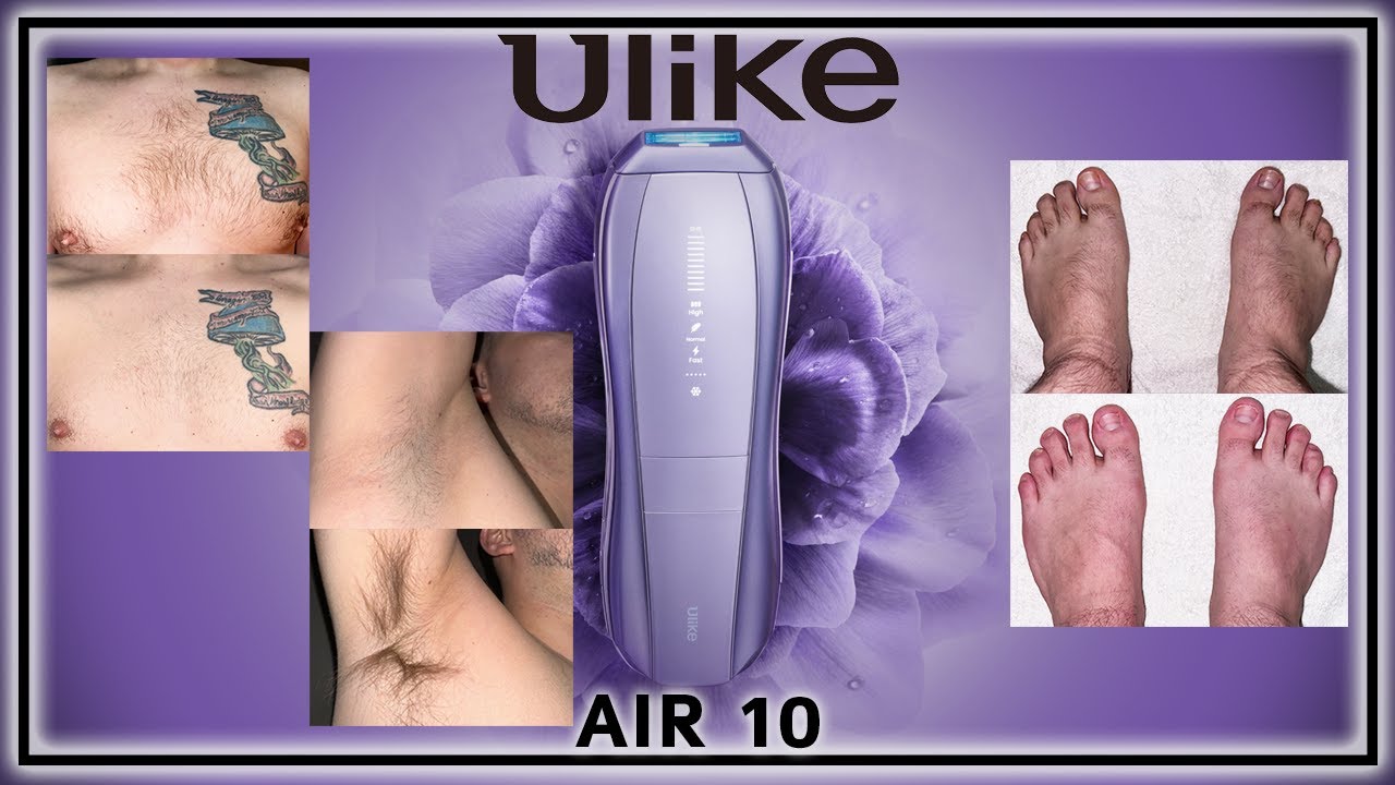 Ulike Air 10 IPL: A Comprehensive Review and Comparison