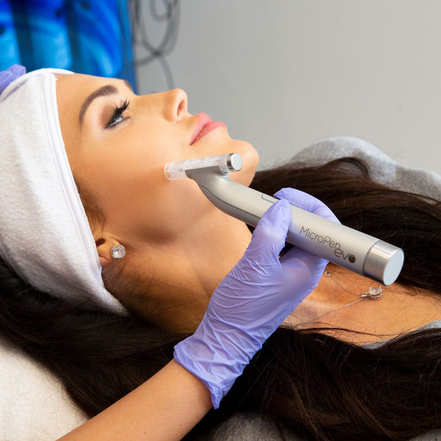 microneedling raleigh nc