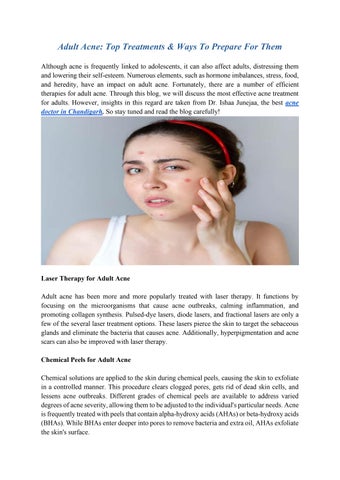 Are Chemical Peels Safe For Skin - Inputs From Skin Expert