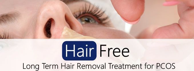 Long Term Hair Removal Treatment for PCOS