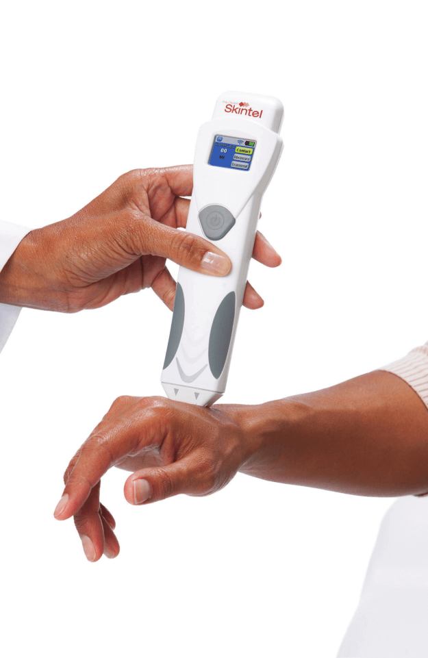 Laser Hair Removal