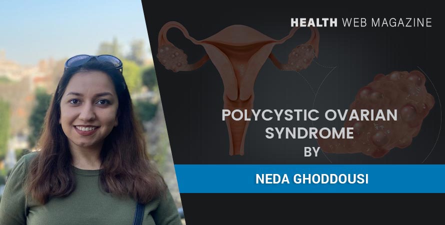 Polycystic Ovarian Syndrome