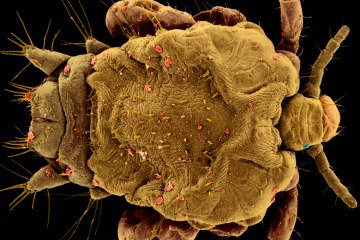 A Pubic Louse (Phthirus pubis)