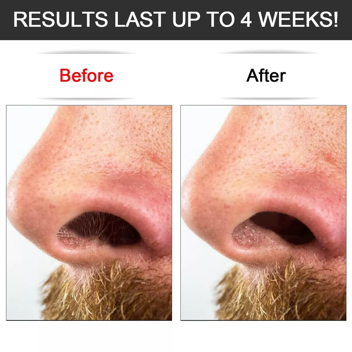 Lip Wax