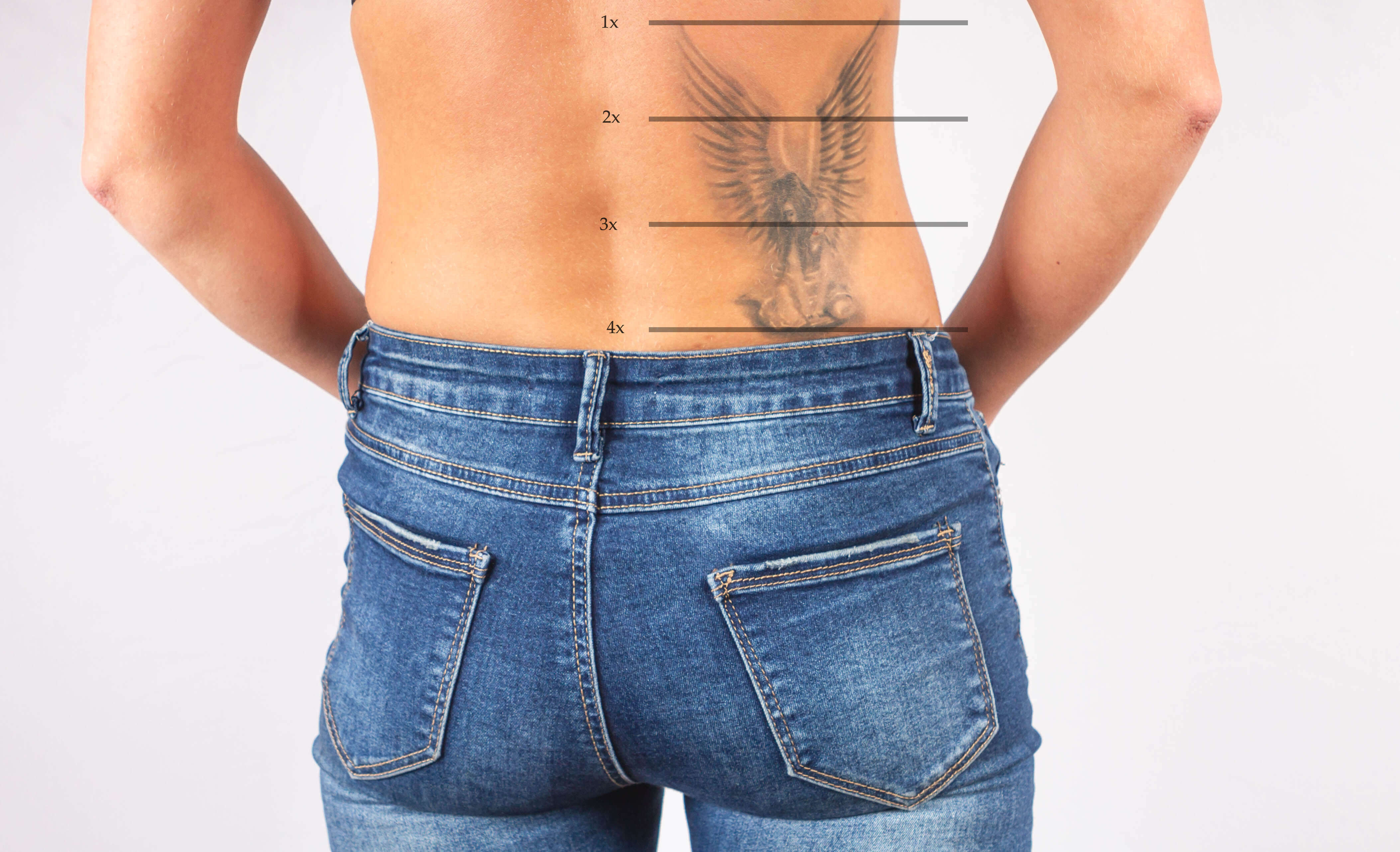 Scottsdale Tattoo Removal Careers