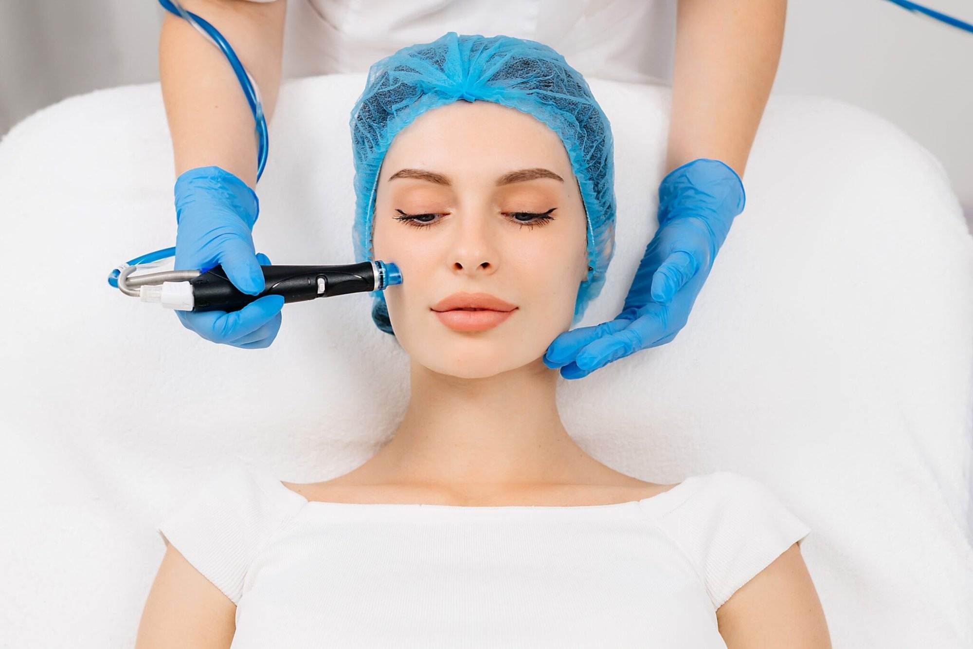 Does HydraFacial Remove Facial Hair?