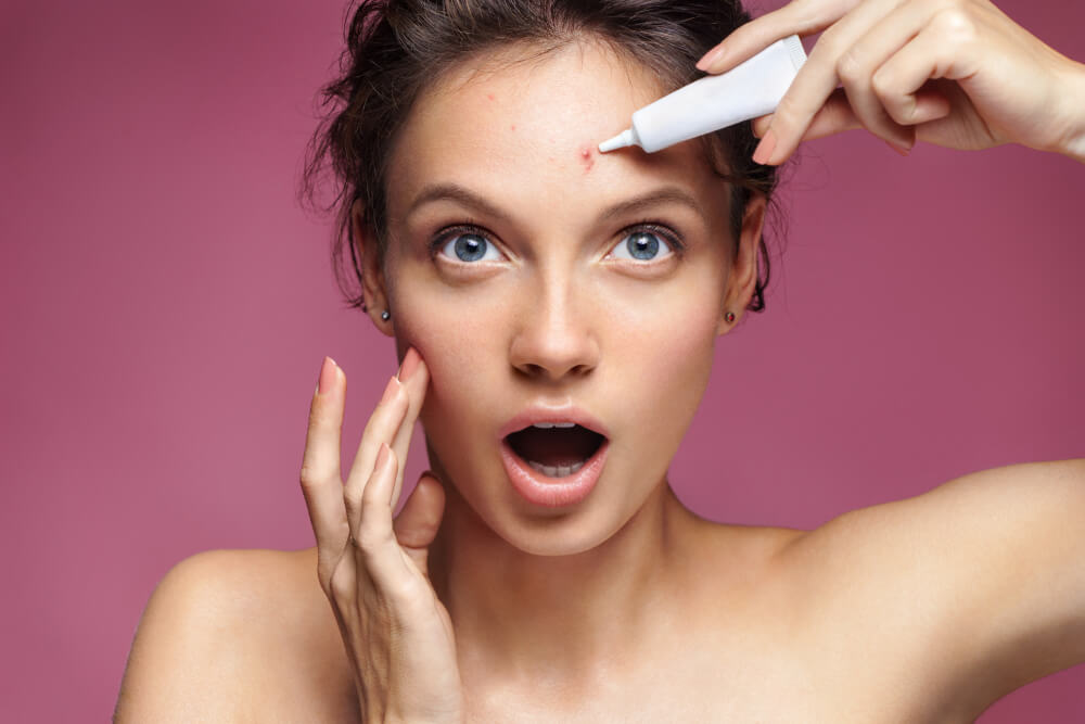 How to treat acne as a medical aesthetician