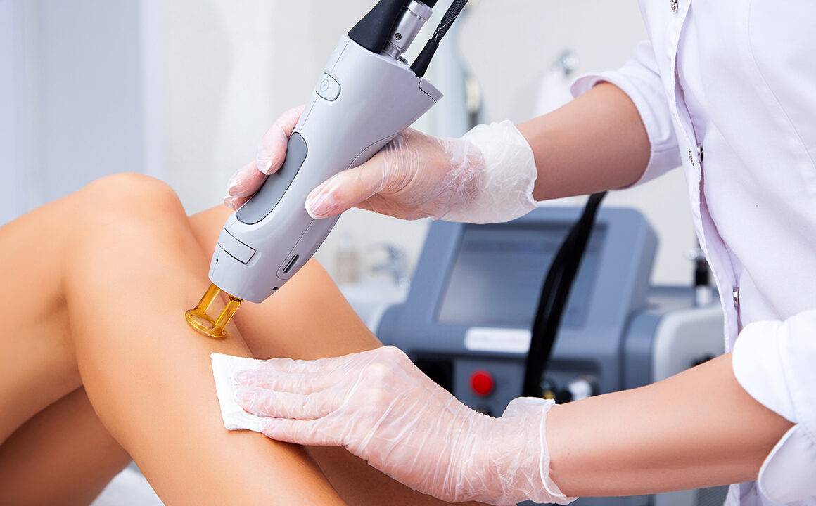 Embracing Smoothness: Electrolysis Hair Removal Trends