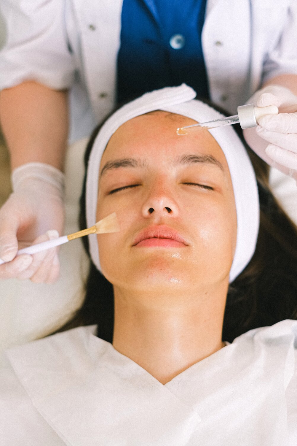 Chemical Peel 101: Different Types You Should Know