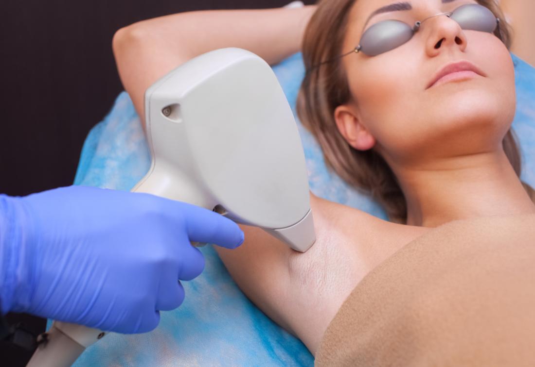 Laser Hair Removal Raleigh