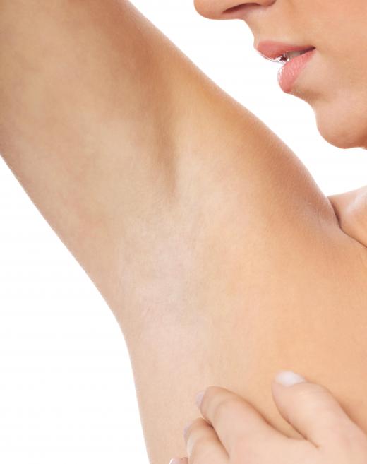 What are the Best Tips for Treating Ingrown Underarm Hair?